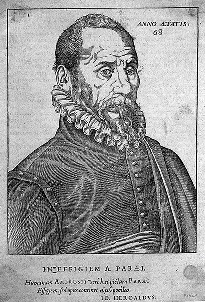 Portrait of Ambroise Paré, age 68, engraving, unsigned, from Latin Opera, 1582, Wellcome Collection(welcomecollection.org)