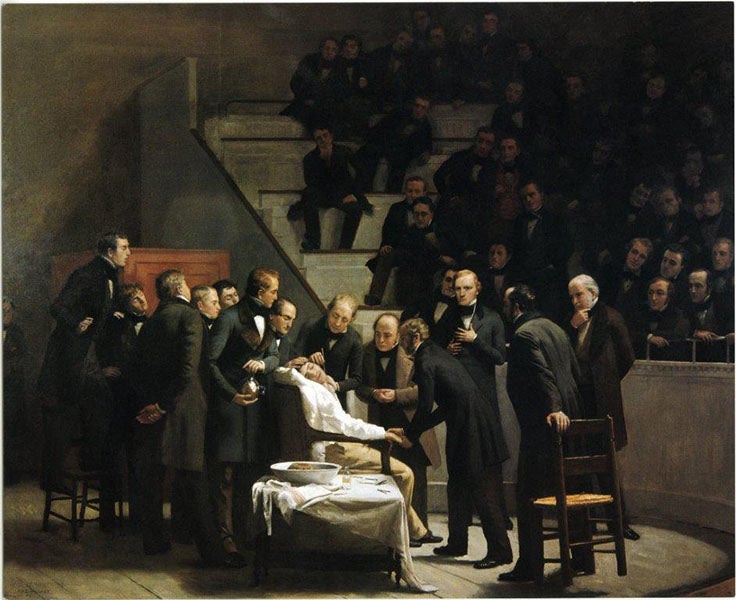 <i>First Operation Under Ether</i>, by Robert C. Hinckley, Boston Medical Library in the Francis A. Countway Library of Medicine, 1882-1893 (Wood Library-Museum of Anesthesiology)