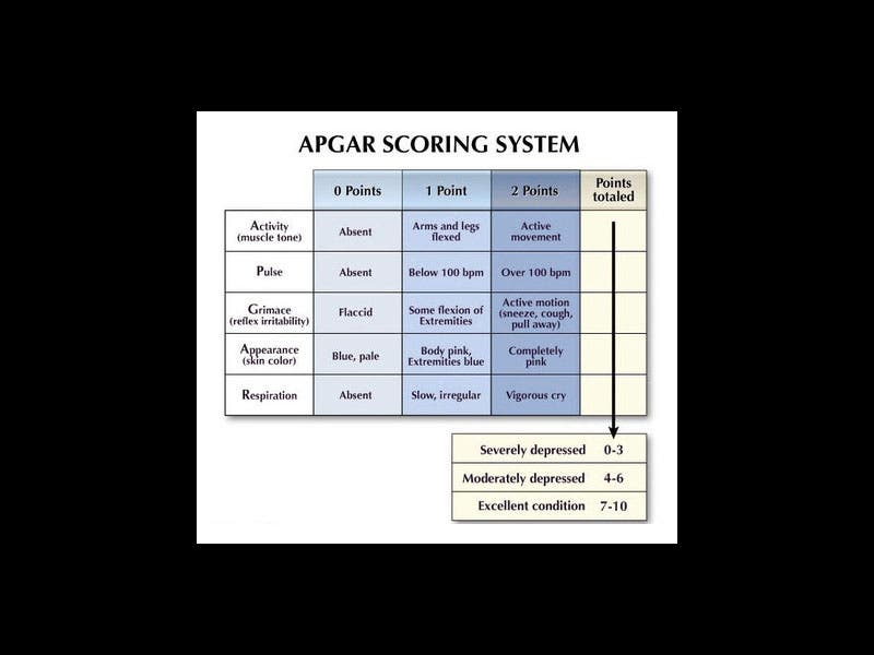 Apgar Score Chart