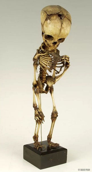 Fetal skeleton, from the collection of Frederik Ruysch, now in the Kunstkamera, Saint Petersburg (collection.kunstkamera.ru/)
