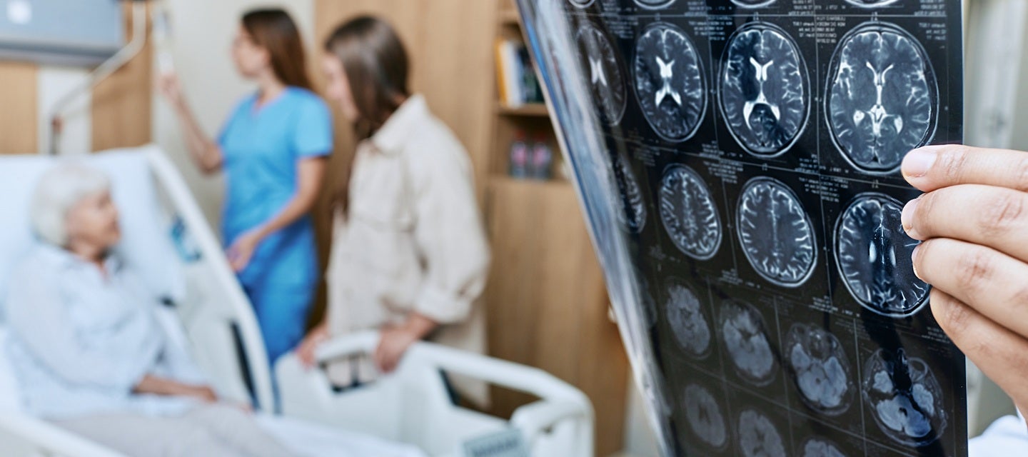 Alzheimer's Disease