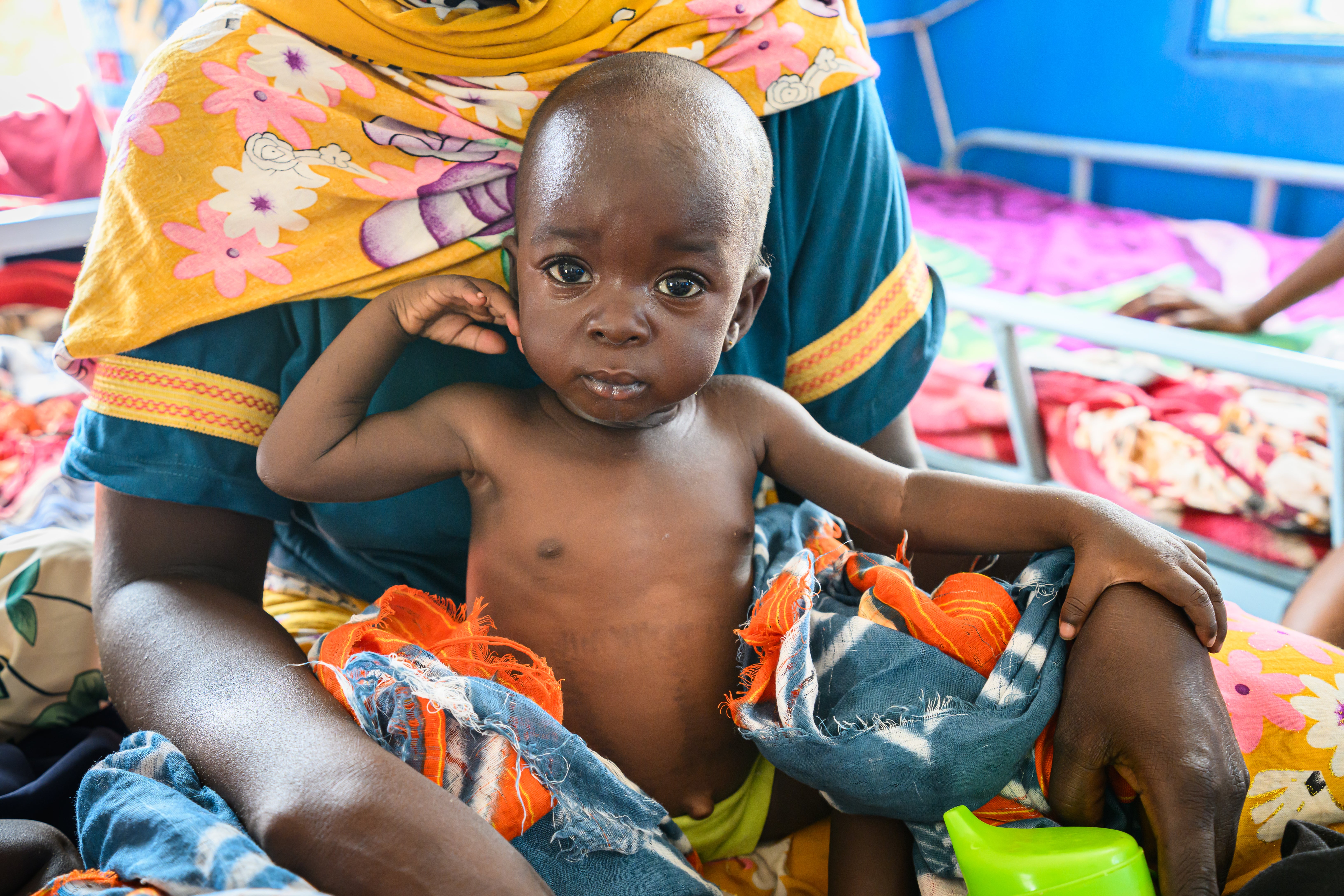 A young Sudanese refugee boy sits up and looks straight into the camera. He is being treated for malnutrition