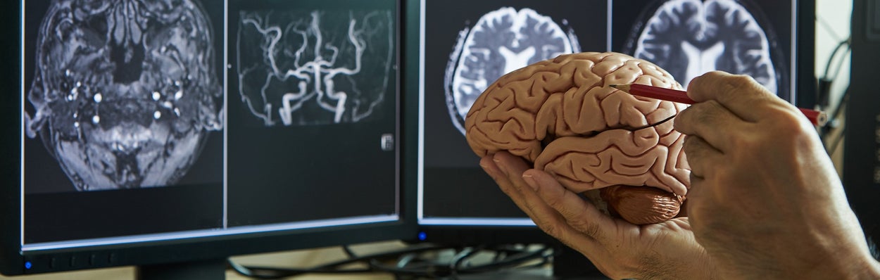 Afbeelding van hersenen