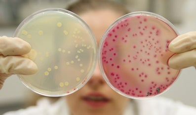 Laborante laat twee petrischaaltjes zien met verschillende bacteriekweken