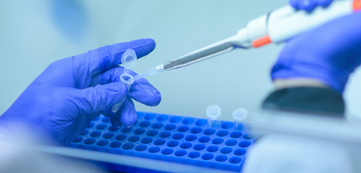 Two projects awarded Open Competition Domain Science – XS - Vrije ...