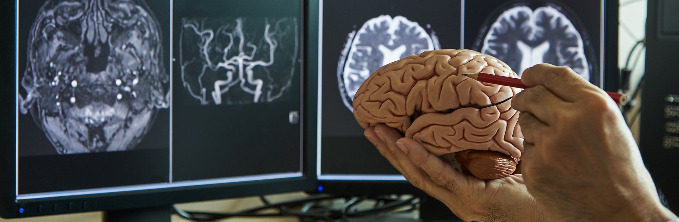 Someone points out a part of the brain with a pencil