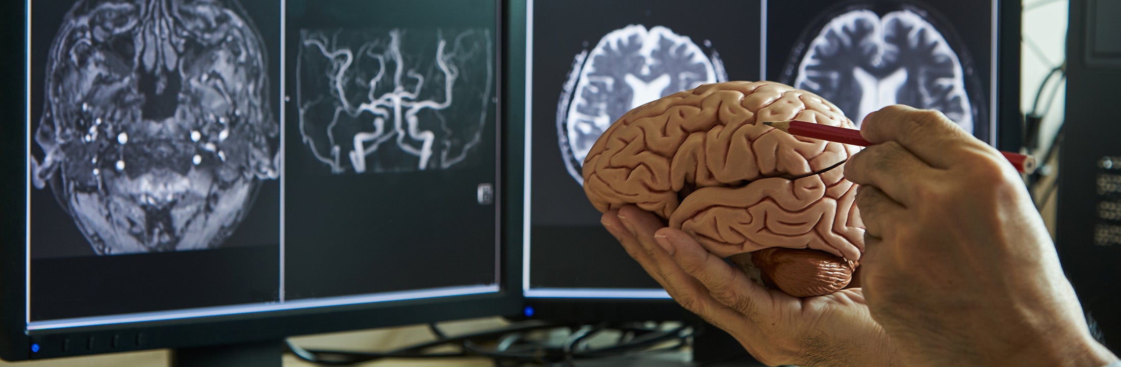 Iemand wijst een deel van de hersenen aan met een potlood