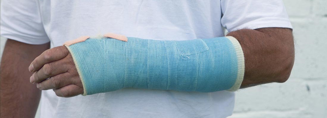 Man With A Broken Wrist. Find the best individual short term disability insurance.