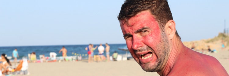 White man at the beach during heatwave