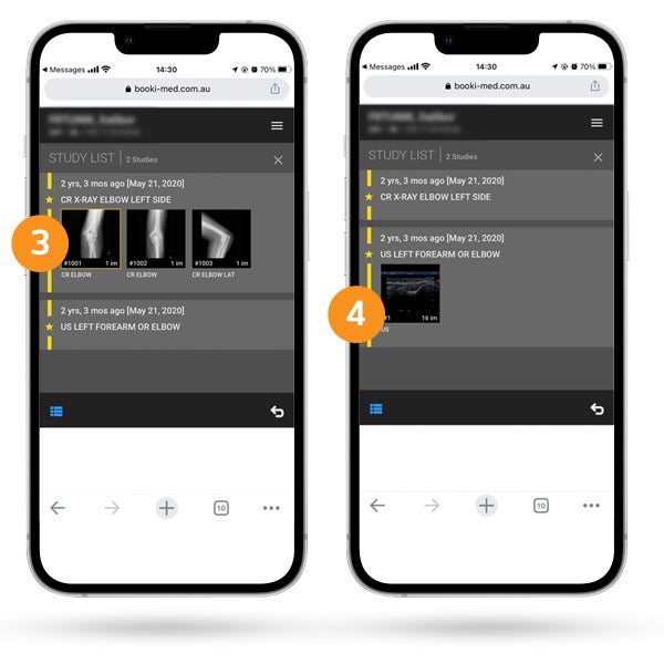 how to view multiple procedures on the mobile part 2