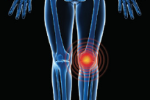 Graphic image of lower body with focus on knee