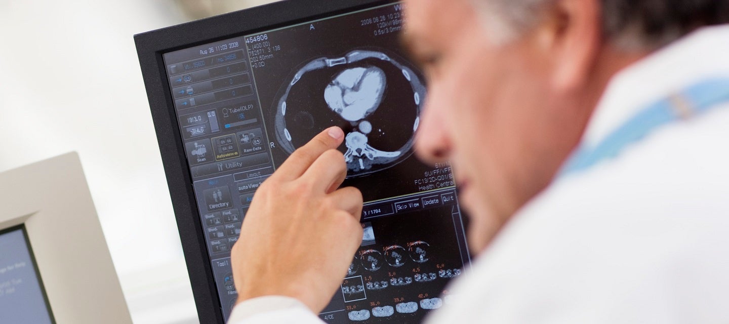 Radiologist look at MRI image on screen