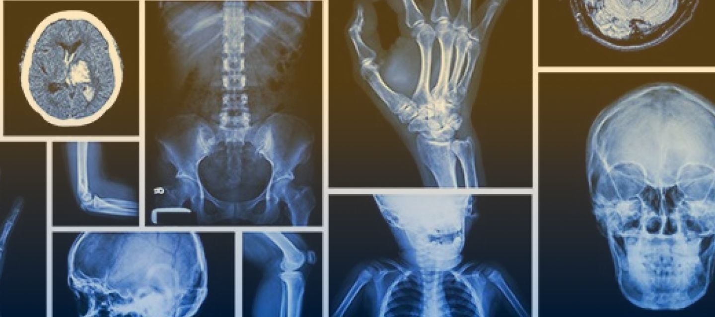 radiographic x-ray images