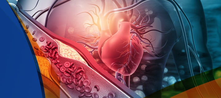 Graphic of a human heart and arteries