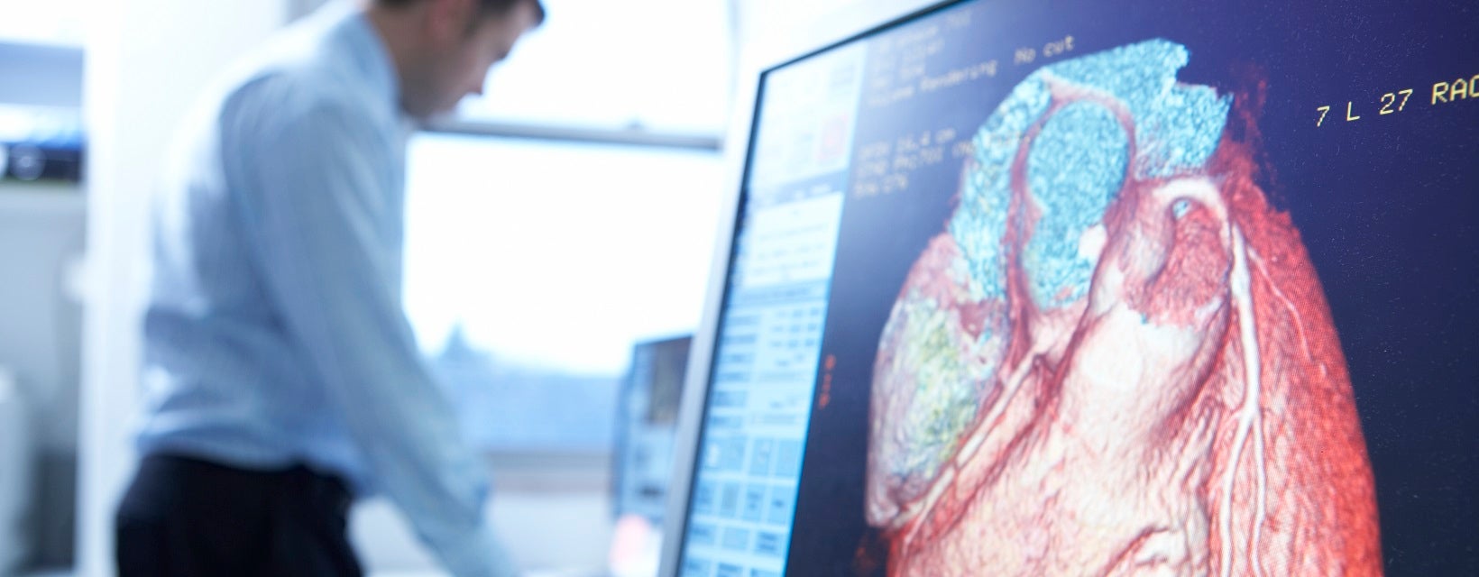 Doctor on the phone with detailed CT image of the heart on screen in foreground