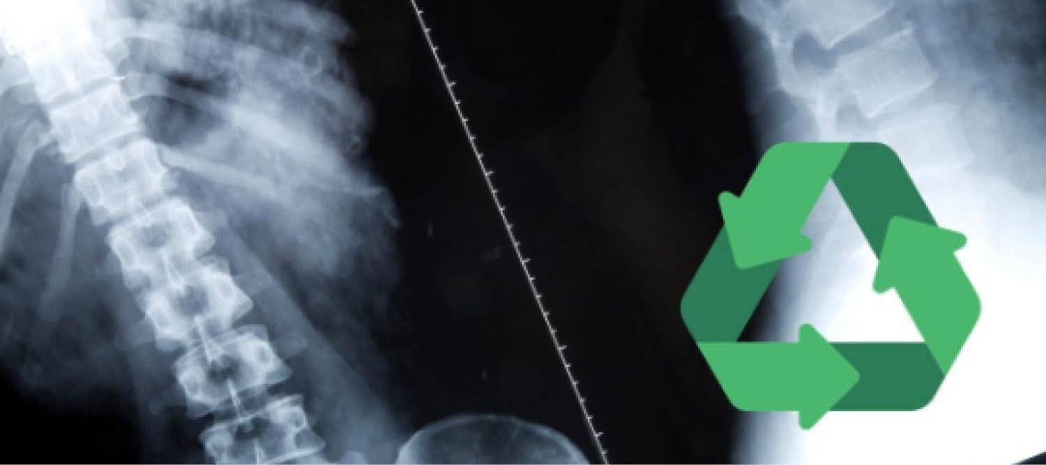 X-ray picture of the spine and a recycling logo