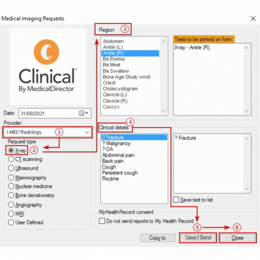 Animated gif demonstrating the 6 key steps to sending an e-Referral