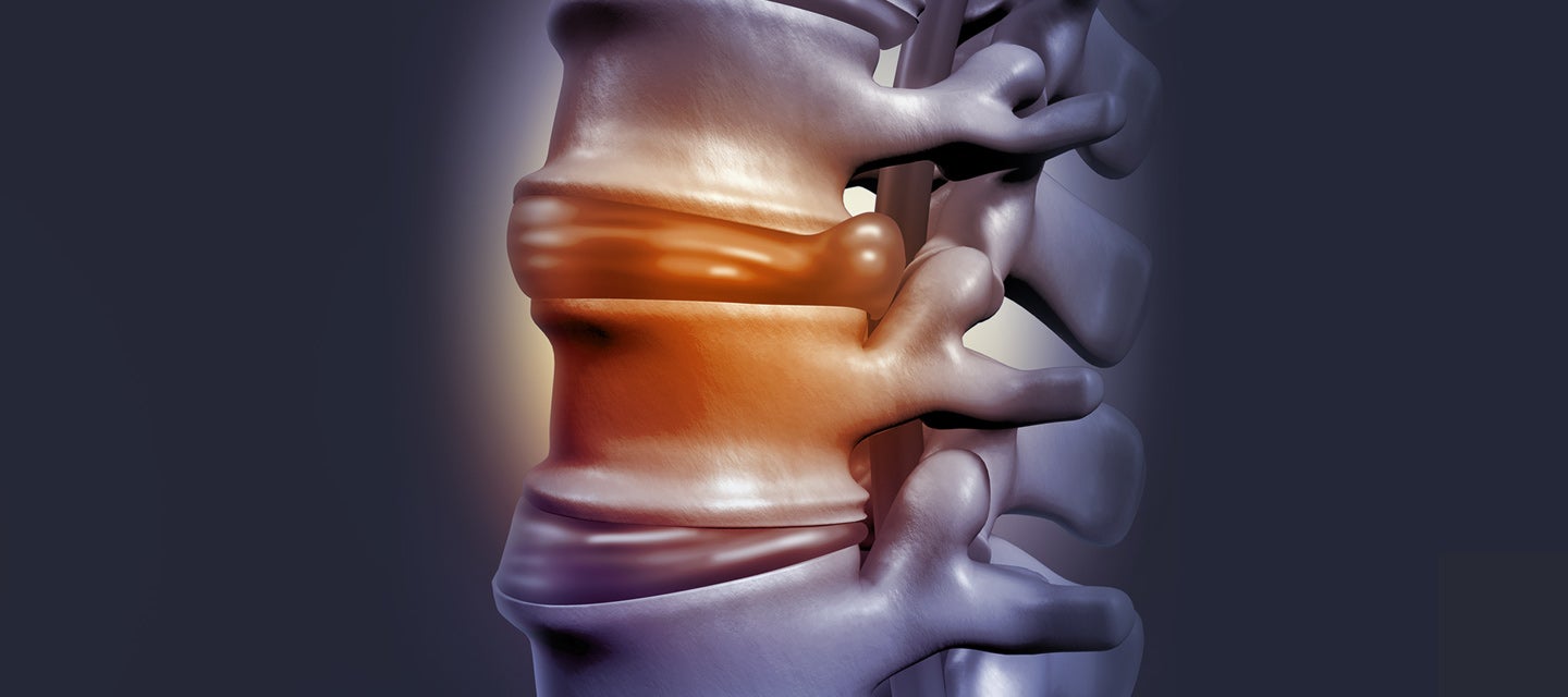 A graphic of the spine