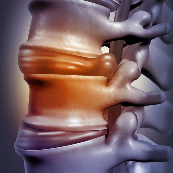 A computer generated image of the spine
