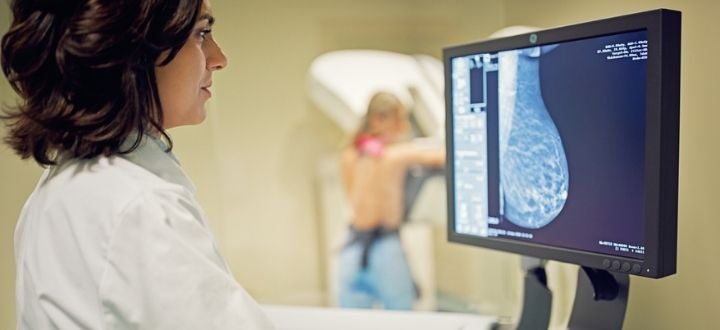 Mammography