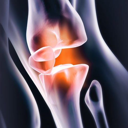 Digital  image of the knee joint