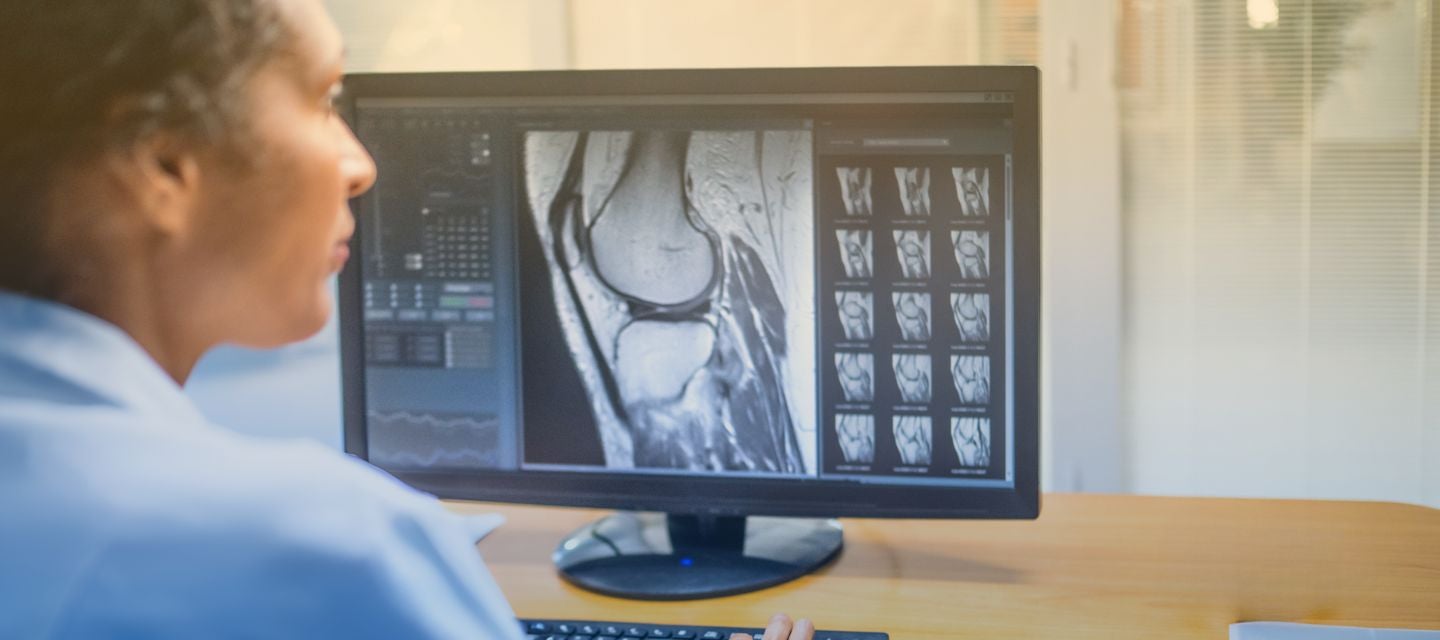 Doctor looking on screen at an MRI 