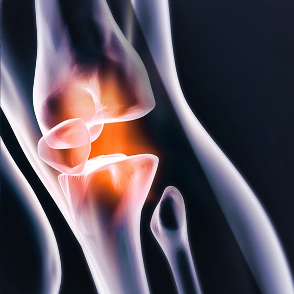 Image of knee