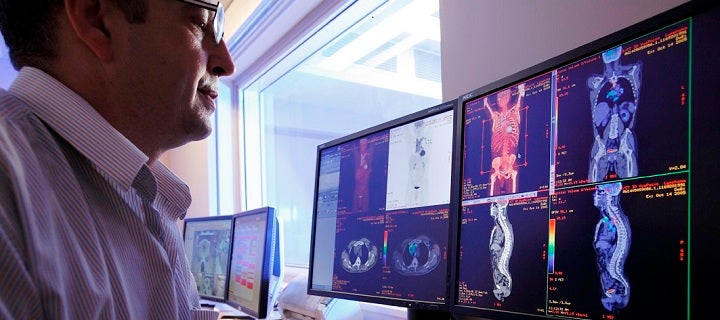 Radiologist reviews PET/CT scans on screen