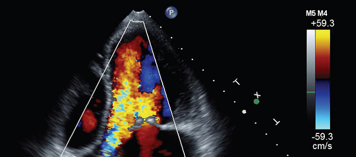 Echocardiogram screen for assessing heart function