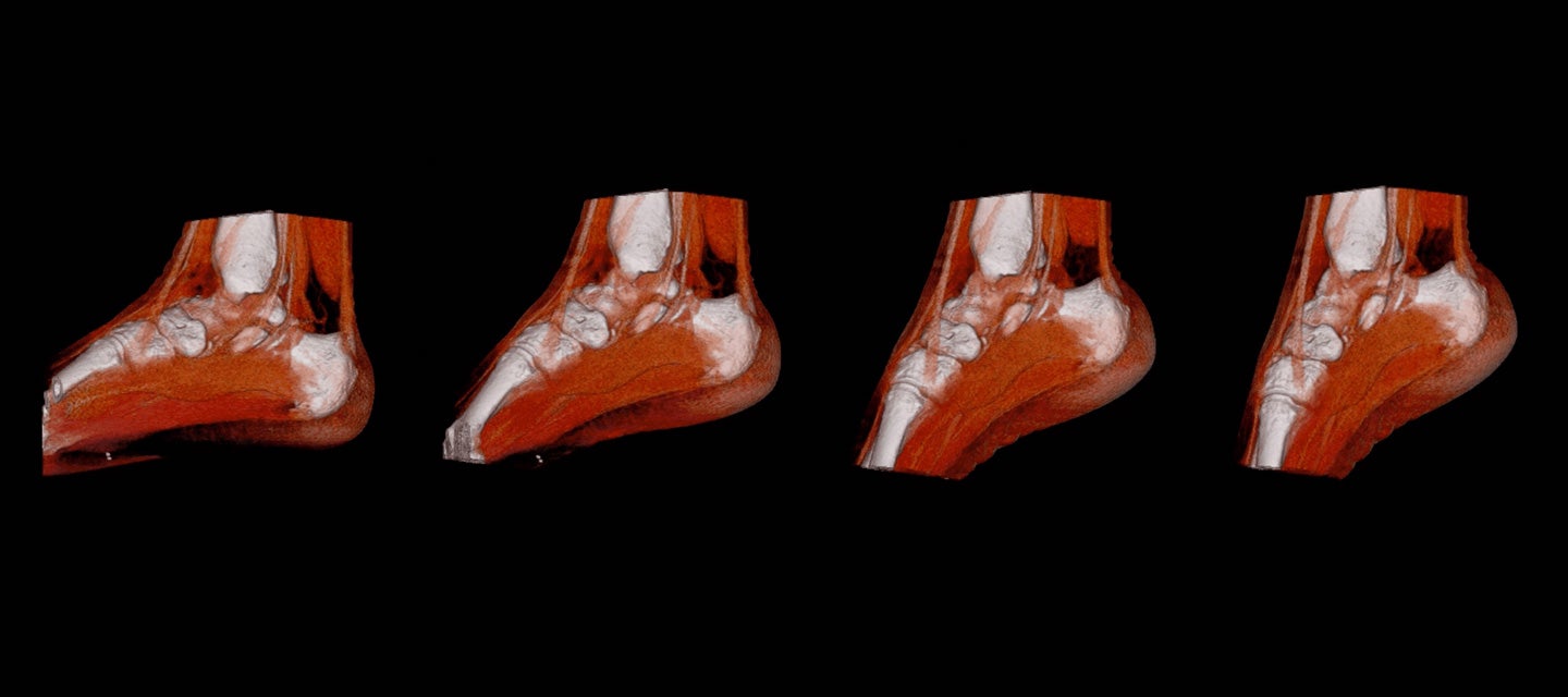 Stills from a 4D CT showing the ankle in a range of movements