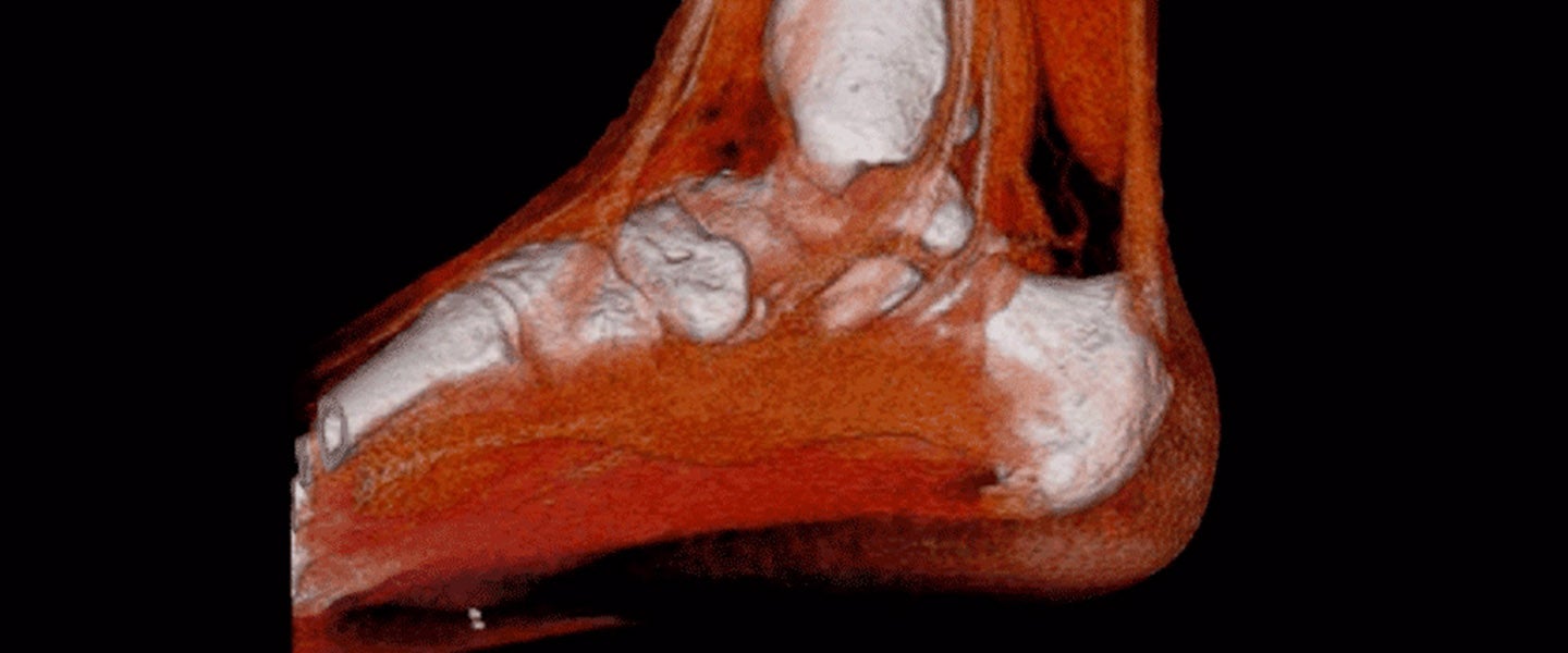 Ankle CT image scan