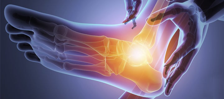 Digital image of foot and ankle joint