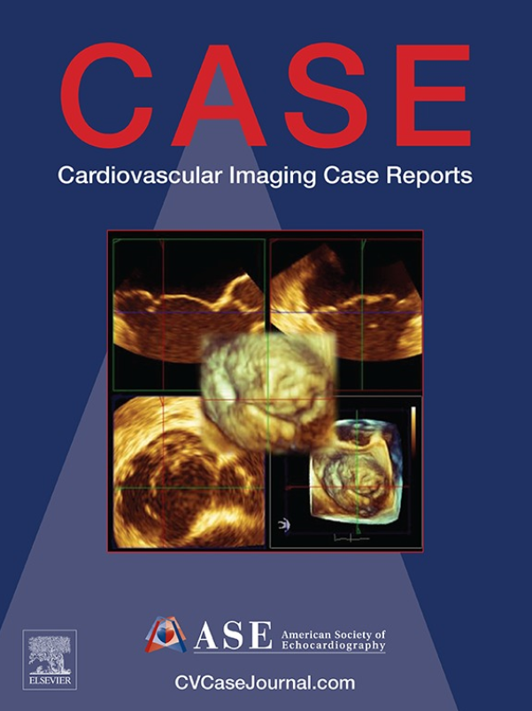 Image of Cardiovascular Imaging Case Reports