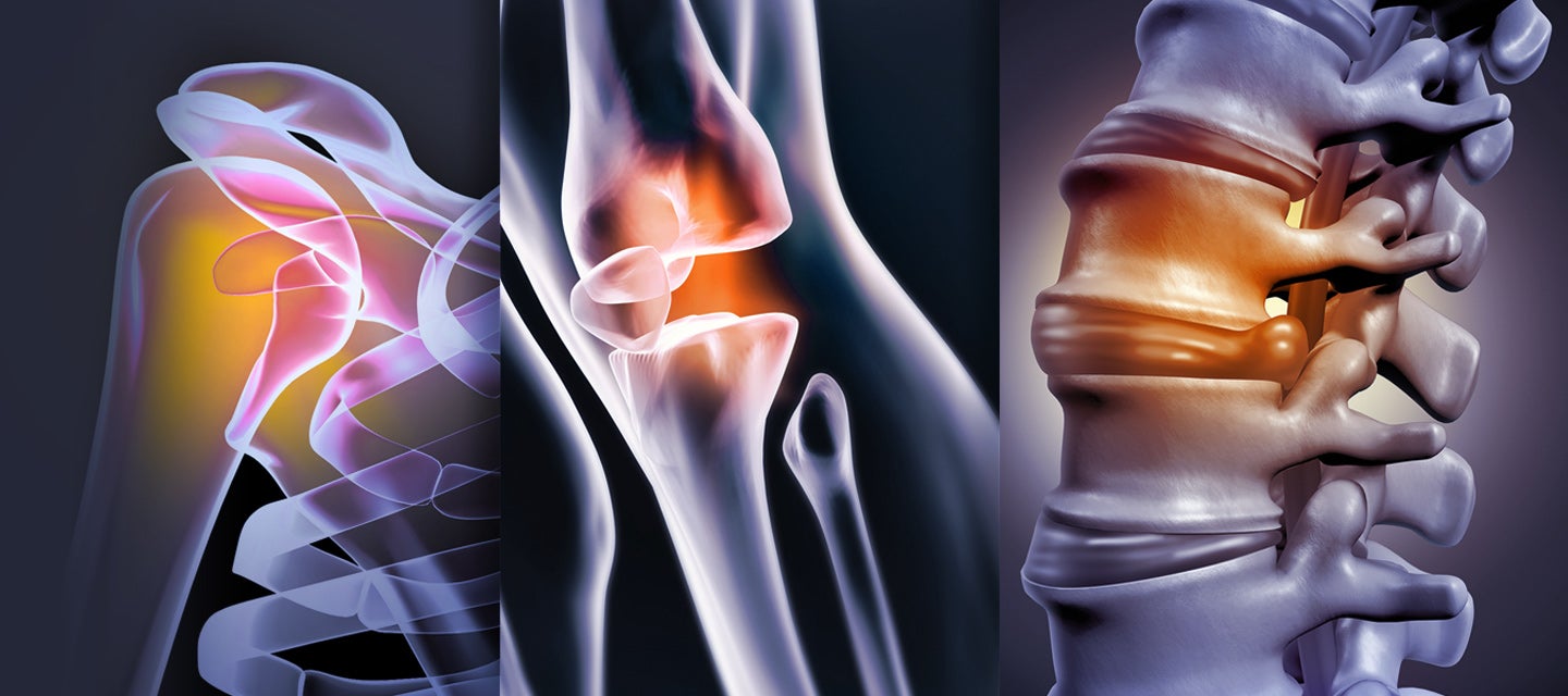 Shoulder, knee and spine bone graphics