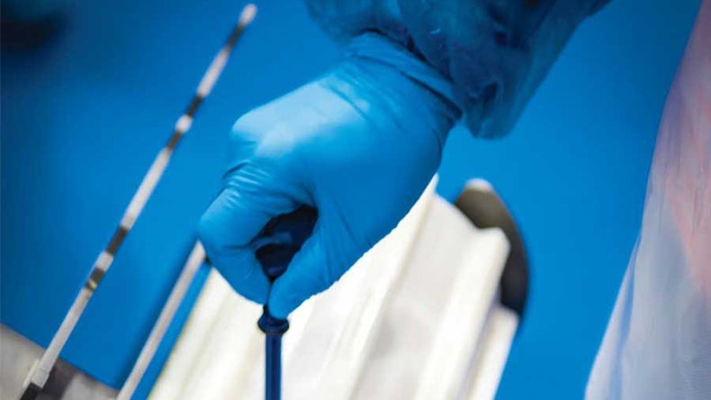 Hand with sterile glove adjusting sprocket screw