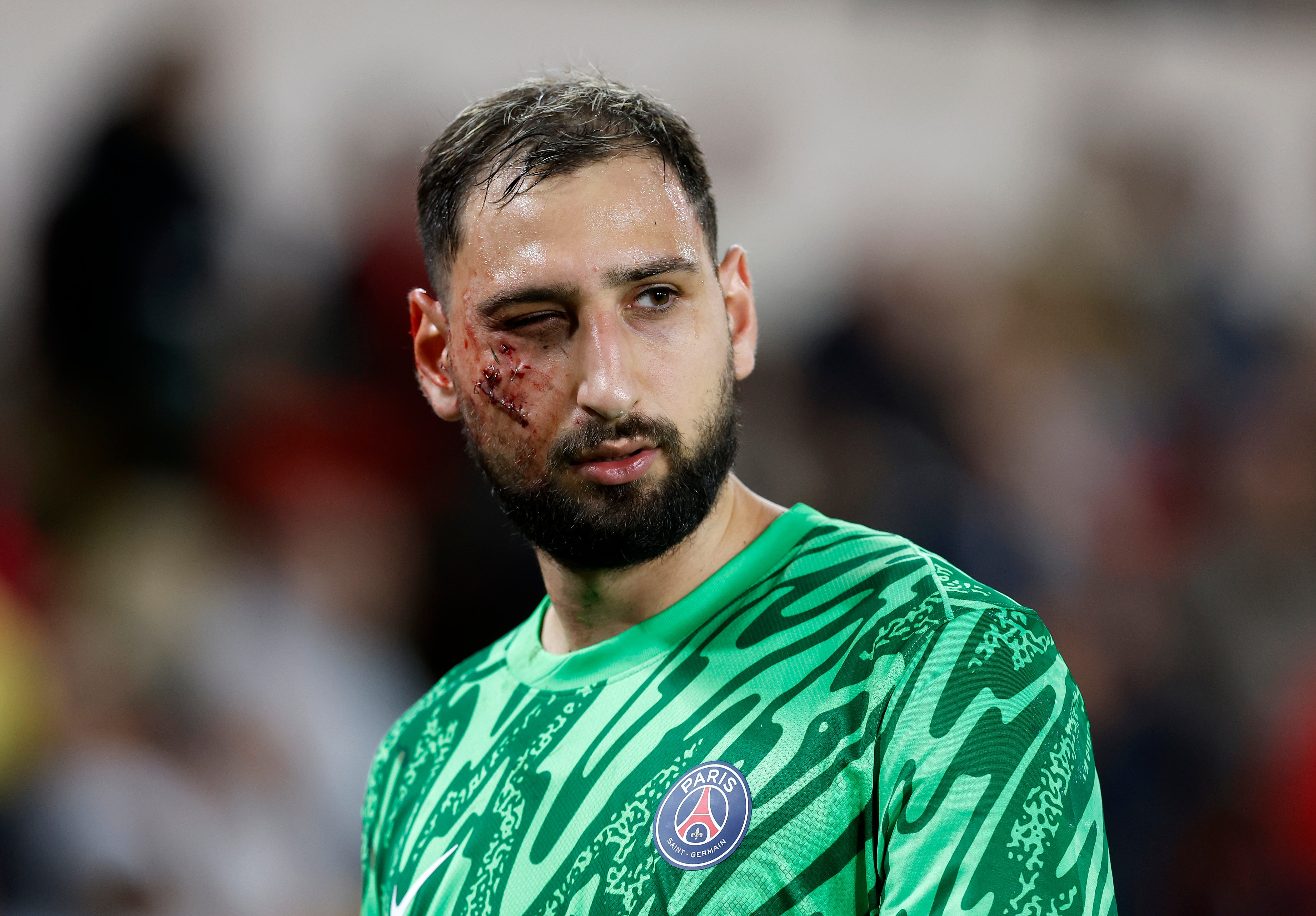 Donnarumma face kick PSG