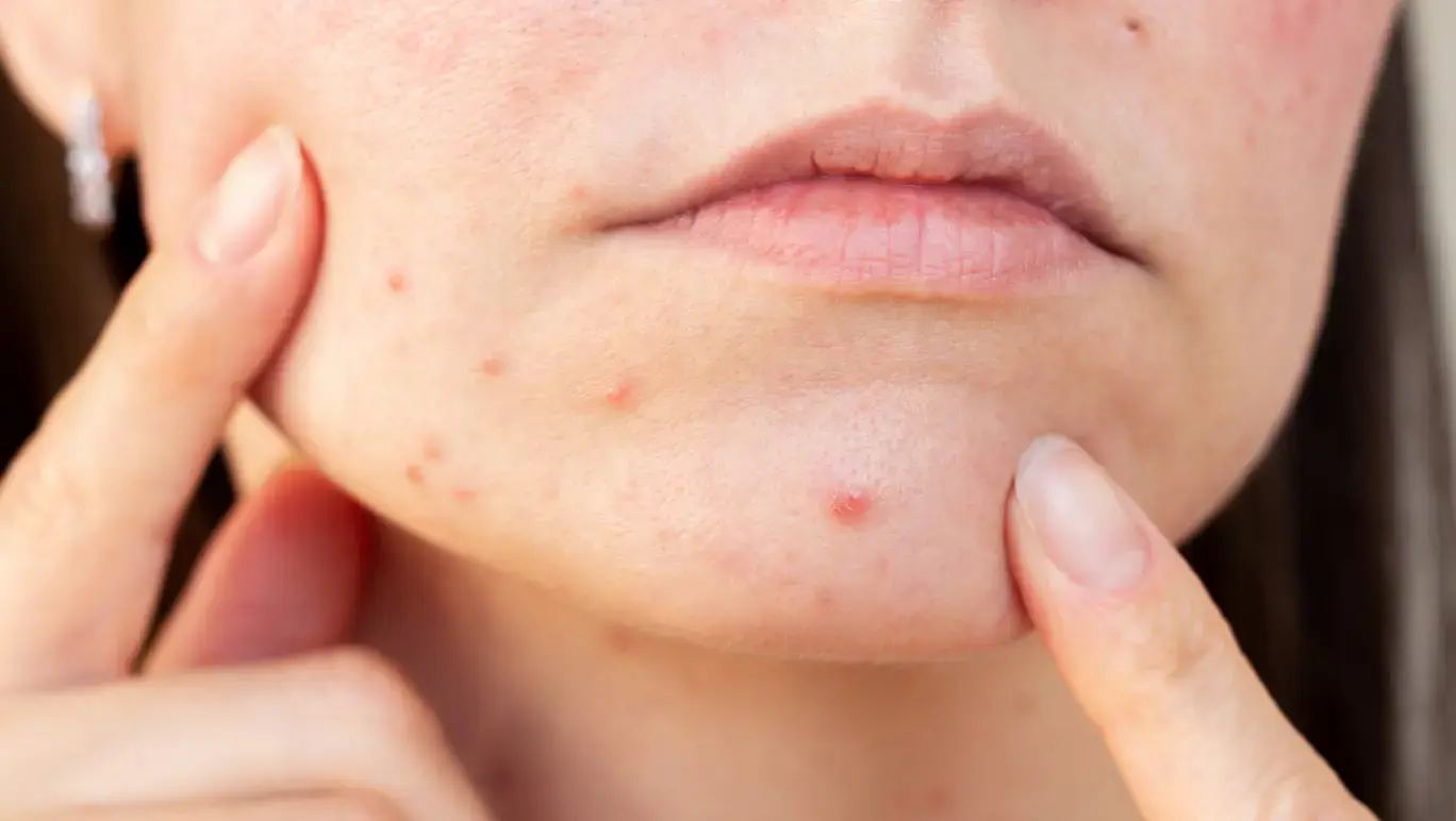 Sensitive skin? These might be doing more harm than good