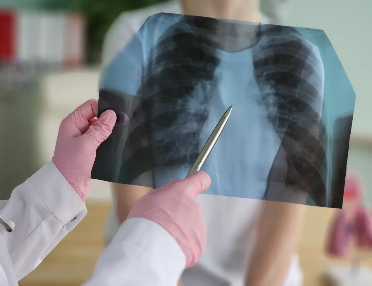 The stages of emphysema and life expectancy