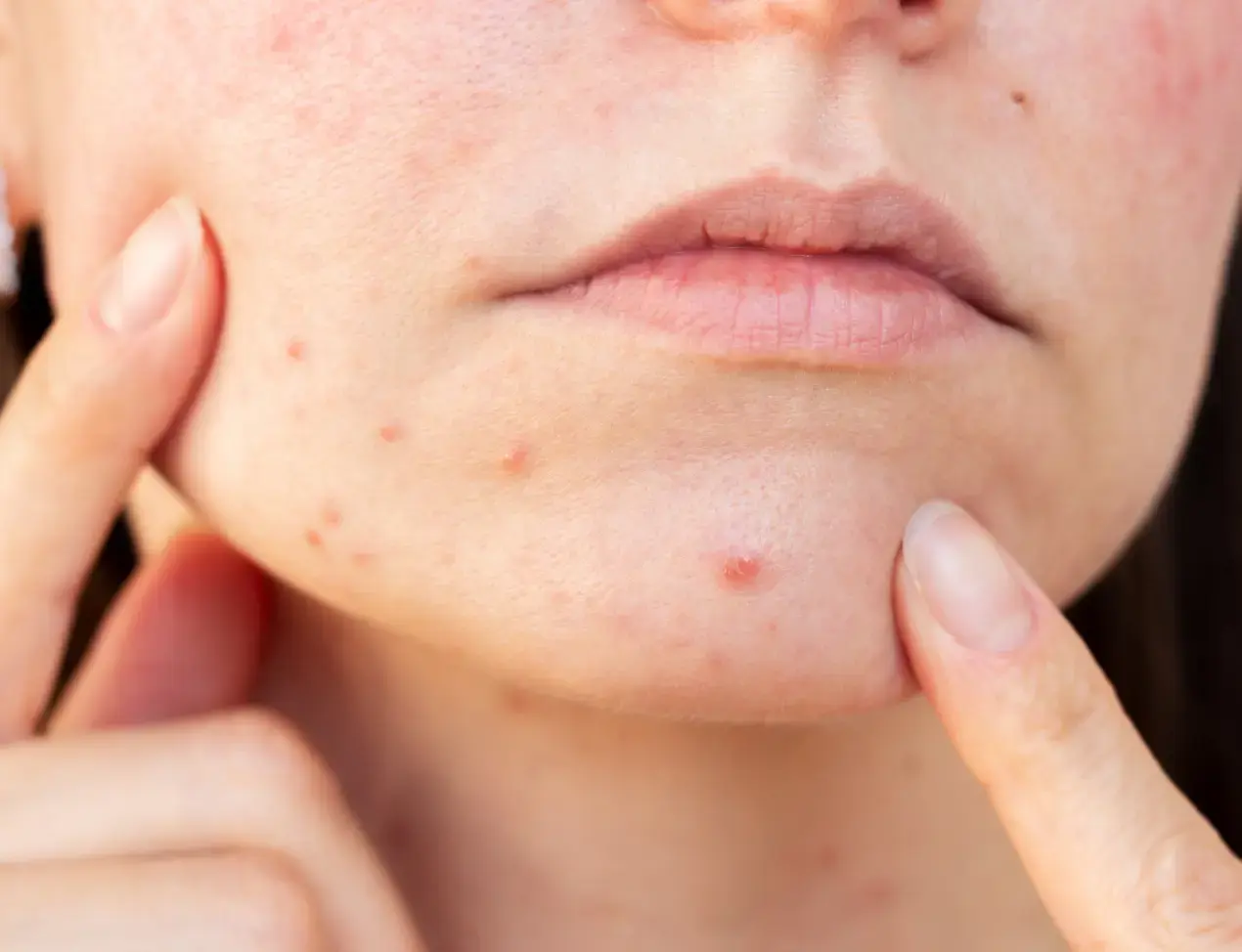 Sensitive skin? These might be doing more harm than good