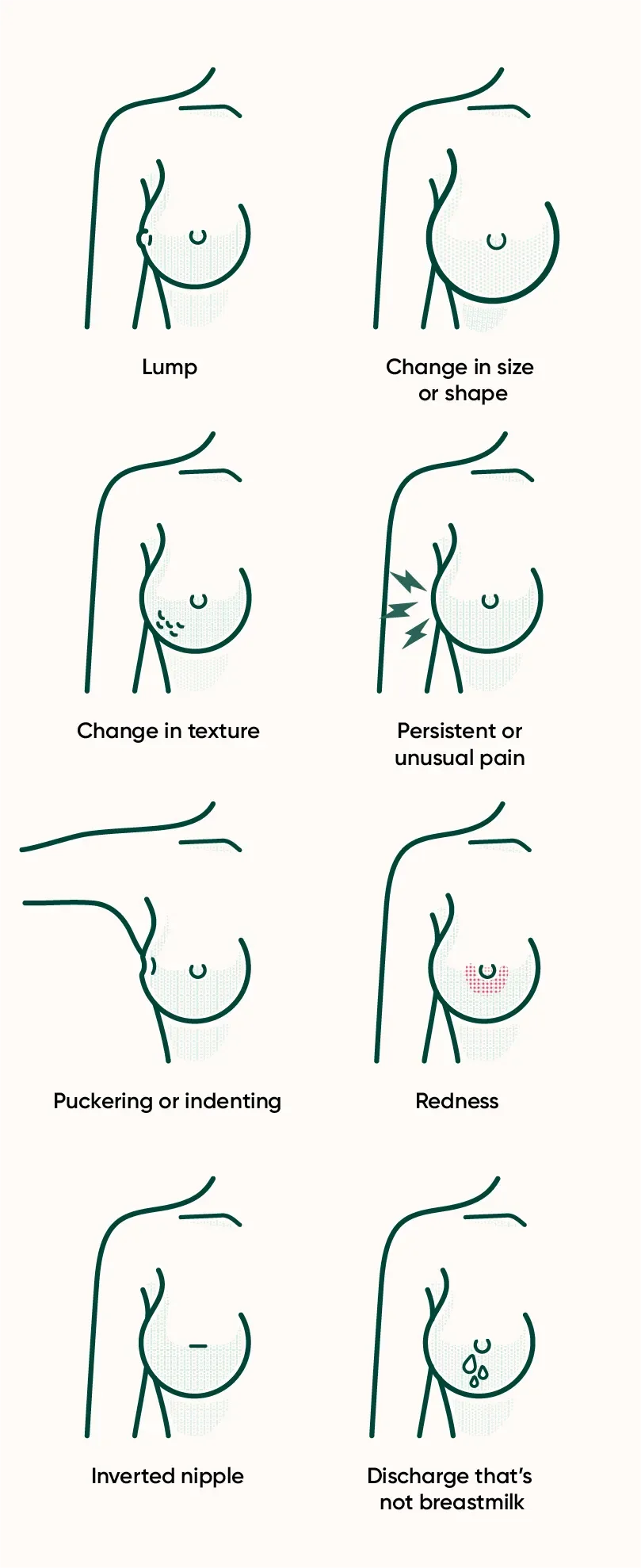 Infographic that highlights some of the key signs to be mindful of that may indicate breast cancer.