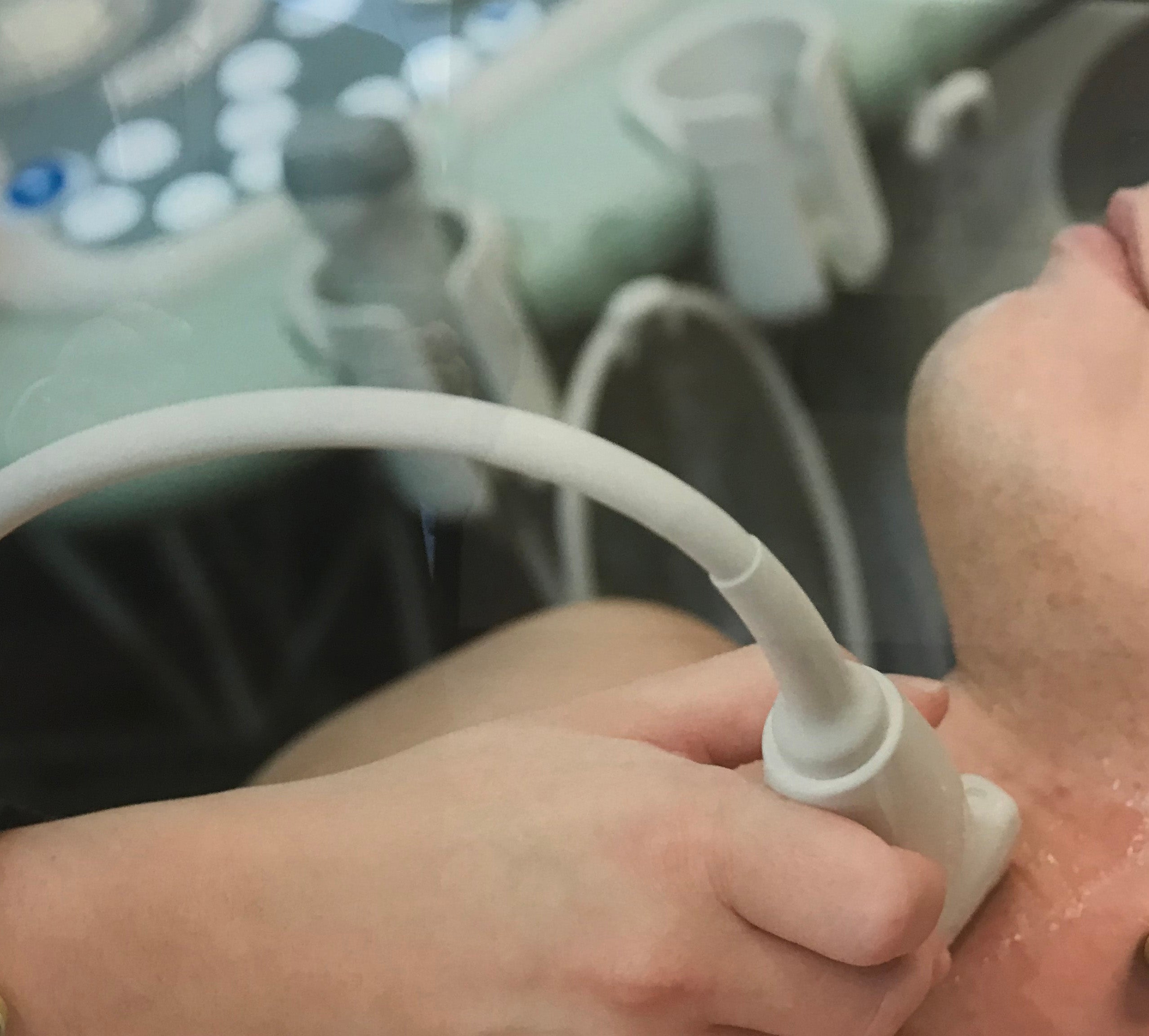 A close-up a vascular sonographer's hand holding a transducer to a patient's neck/carotid artery