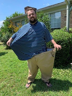 Dalton after weight loss, in the same clothes as pre-surgery shown very loose on him