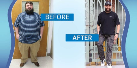 Dalton Musslewhite, weight loss surgery patient, before surgery and after surgery photos showing differences in body 