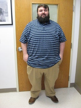 Patient Dalton before surgery, at nearly 500 pounds