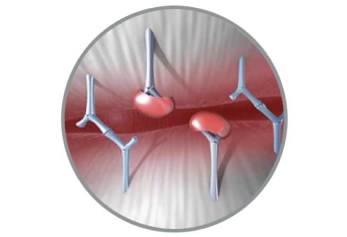 RESILIA Tissue Durabilityimg