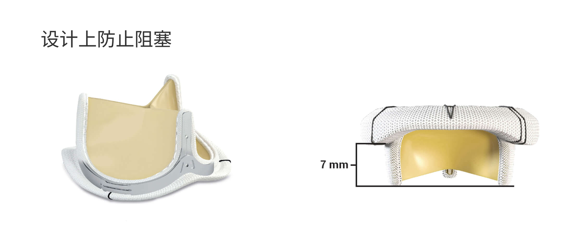 Designed to prevent obstruction