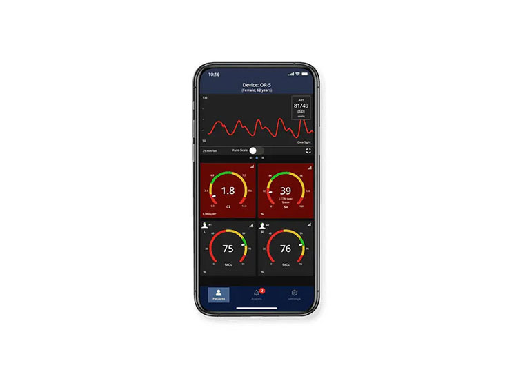 HemoSphere monitor - Viewfinder remote app