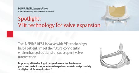 INSPIRIS RESILIA aortic valve brochure
