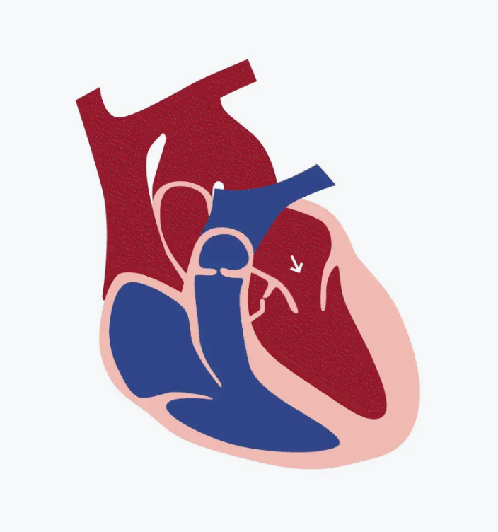 Understanding Regurgitation and Stenosis