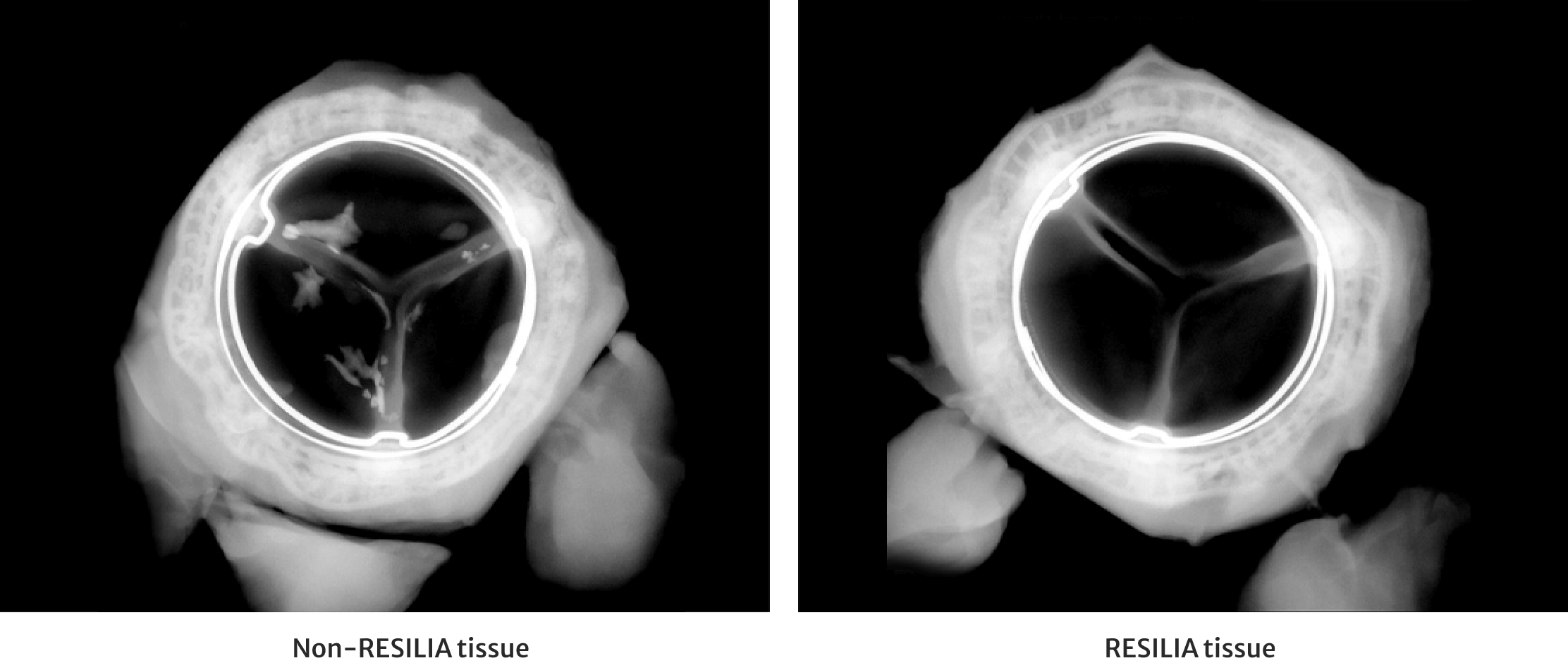 resilia valve comparison